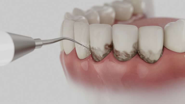 Trusted Tooth Extraction service in Nutter Fort, WV - Dentist Open Now